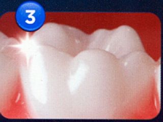 Nach 3 Wochen weißere Zähne im Vergleich zur Professional Care Serie